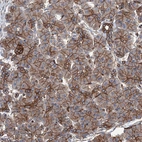 Anti-NMRAL1 Antibody