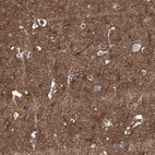 Immunohistochemical staining of human cerebral cortex shows strong positivity in neuronal processes in neuropil.