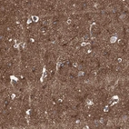 Immunohistochemical staining of human cerebral cortex shows strong positivity in neuronal processes in neuropil.