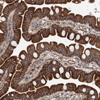 Immunohistochemical staining of human small intestine shows strong cytoplasmic and membranous positivity in glandular cells.