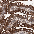 Immunohistochemical staining of human small intestine shows strong cytoplasmic and membranous positivity in glandular cells.