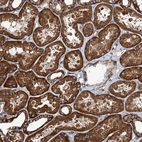 Immunohistochemical staining of human kidney shows strong cytoplasmic positivity in cells in tubules.