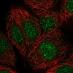 Immunofluorescent staining of human cell line MCF7 shows localization to nucleus.