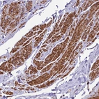 Anti-ZNF2 Antibody