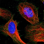 Immunofluorescent staining of human cell line U-2 OS shows localization to plasma membrane.