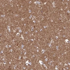 Immunohistochemical staining of human cerebral cortex shows high expression.