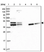 Lane 1: Marker [kDa] 250, 130, 95, 72, 55, 36, 28, 17, 10_br/_Lane 2: Human cell line RT-4_br/_Lane 3: Human cell line U-251MG sp_br/_Lane 4: Human plasma (IgG/HSA depleted)_br/_Lane 5: Human liver tissue_br/_Lane 6: Human tonsil tissue