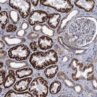 Anti-GCSH Antibody