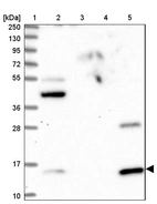 Lane 1: Marker [kDa] 250, 130, 95, 72, 55, 36, 28, 17, 10_br/_Lane 2: Human cell line RT-4_br/_Lane 3: Human cell line U-251MG sp_br/_Lane 4: Human plasma (IgG/HSA depleted)_br/_Lane 5: Human liver tissue