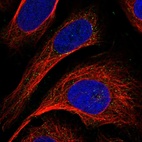 Immunofluorescent staining of human cell line U-2 OS shows localization to vesicles.