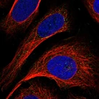 Immunofluorescent staining of human cell line U-2 OS shows localization to vesicles.