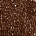 Immunohistochemical staining of human liver shows strong cytoplasmic-nucleus positivity in hepatocytes.