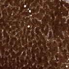 Immunohistochemical staining of human liver shows strong cytoplasmic-nucleus positivity in hepatocytes.