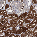 Immunohistochemical staining of human kidney shows strong cytoplasmic-nucleus positivity in cells in tubules.