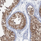 Immunohistochemical staining of human testis shows moderate cytoplasmic-nucleus positivity in cells in seminiferous ducts.