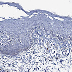 Immunohistochemical staining of human skin shows no positivity in squamous epithelial cells as expected.