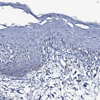 Immunohistochemical staining of human skin shows no positivity in squamous epithelial cells as expected.
