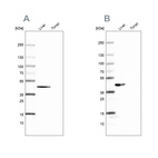 Western blot analysis using Anti-FAH antibody HPA041370 (A) shows similar pattern to independent antibody HPA044093 (B).