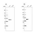 Western blot analysis using Anti-FAH antibody HPA041370 (A) shows similar pattern to independent antibody HPA044093 (B).