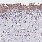 Anti-OAS3 Antibody