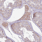 Anti-TRAPPC4 Antibody