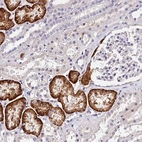 Immunohistochemical staining of human kidney shows strong cytoplasmic positivity in cells in tubules.