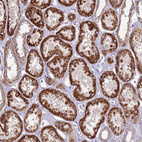 Immunohistochemical staining of human kidney shows strong granular cytoplasmic positivity in cells in tubules.