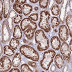 Immunohistochemical staining of human kidney shows strong granular cytoplasmic positivity in cells in tubules.