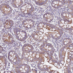Immunohistochemical staining of human small intestine shows moderate granular cytoplasmic positivity in glandular cells.