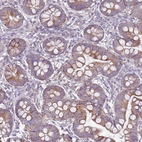 Immunohistochemical staining of human small intestine shows moderate granular cytoplasmic positivity in glandular cells.