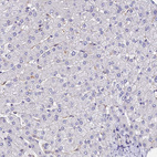 Immunohistochemical staining of human liver shows no positivity in hepatocytes.