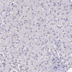 Immunohistochemical staining of human liver shows no positivity in hepatocytes.