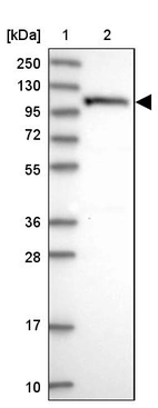 Lane 1: Marker [kDa] 250, 130, 95, 72, 55, 36, 28, 17, 10_br/_Lane 2: Human cell line RT-4