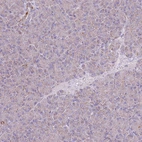 Immunohistochemical staining of human pancreas shows very weak granular cytoplasmic positivity in exocrine glandular cells.