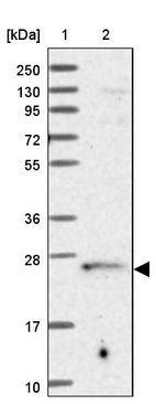 Lane 1: Marker [kDa] 250, 130, 95, 72, 55, 36, 28, 17, 10_br/_Lane 2: Human cell line RT-4