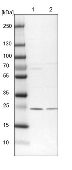 Lane 1: NIH-3T3 cell lysate (Mouse embryonic fibroblast cells)_br/_Lane 2: NBT-II cell lysate (Rat Wistar bladder tumour cells)