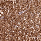 Anti-C16orf46 Antibody