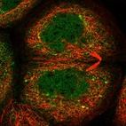 Immunofluorescent staining of human cell line A-431 shows localization to nucleoplasm & cytosol.