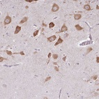 Anti-LRRC9 Antibody