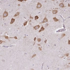 Anti-LRRC9 Antibody