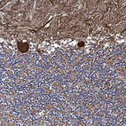 Anti-PTCD3 Antibody