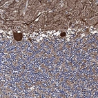 Anti-PTCD3 Antibody