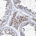 Immunohistochemical staining of human testis shows moderate granular cytoplasmic positivity in Leydig cells.