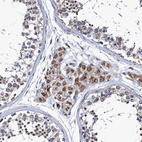 Anti-PTCD3 Antibody