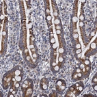 Immunohistochemical staining of human duodenum shows strong granular cytoplasmic positivity in glandular cells.