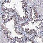 Immunohistochemical staining of human prostate shows weak granular cytoplasmic positivity in glandular cells.