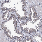 Immunohistochemical staining of human prostate shows weak granular cytoplasmic positivity in glandular cells.