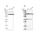 Western blot analysis using Anti-PTCD3 antibody HPA041382 (A) shows similar pattern to independent antibody HPA041154 (B).