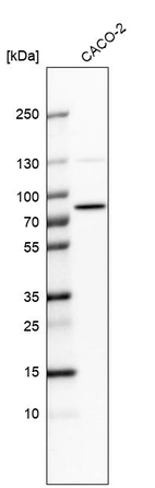Western blot analysis in human cell line CACO-2.