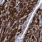 Anti-TXNDC11 Antibody